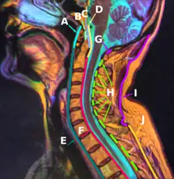 E:Anterior longitudinal ligament