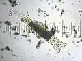 Lateral view of a bdelloid.