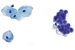 B