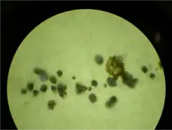 pycnidia of "Diplodia hederae" growing on a potato dextrose agar plate