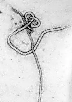 Transmission electron micrograph of ebola virus virions