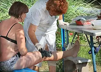 applying therapeutic mud on a woman's leg
