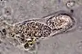 Two muriform spores in an ascus from E.&nbsp;petrolepideum; photographed through a compound microscope, x1000