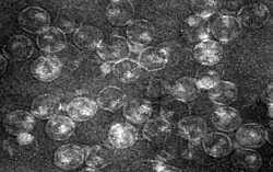 Equine encephalosis virus virion particles