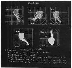 Widening of angioscotoma under various conditions (holding head lower than trunk; holding the breath; making digital pressure on the same eye; (a vein) on opposite eye; (an artery) on opposite eye).