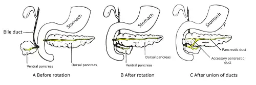 Formation of an accessory pancreatic duct