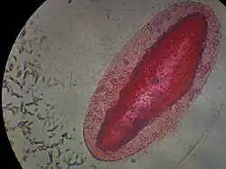 Prokaryotes (small cylindrical cells, bacteria, on left) and a single-celled eukaryote, Paramecium
