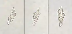 Three examples of cells with an elongated shape with a distinctive spiral in the center and pointed ends.