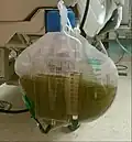 Green urine during long term infusion of the sedative propofol.