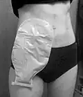 Ostomy bag