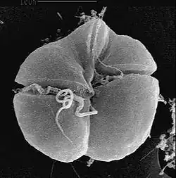 The mixotrophic dinoflagellate Karenia brevis causes harmful red tides