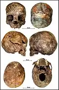 Burial 27 - Cranium