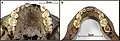 Burial 27 - Dental eruption.