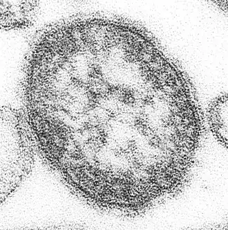 Transmission electron micrograph of measles virus