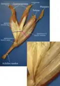 Photograph of the gastrocnemius-soleus junction.