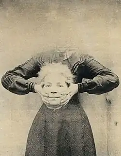 Unknown photographer, UK. Headless woman, 1900.