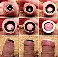 Stretching the foreskin opening with flesh tunnel of different diameters