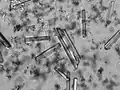 Another image from the same urine sample as with the image on the left.