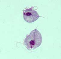Trichomonas vaginalis, the causative agent of trichomoniasis