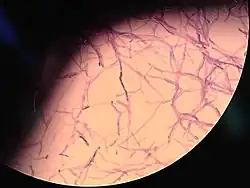Yarrowia lipolytica, a fungus associated with necrobiomes and mycoremediation of decomposing organisms, which Stanway compared to the mycelial network in Star Trek. The fictional network recycles matter and creates life, as seen in "Saints of Imperfection" (Discovery S2E5). Dried and heat-killed Y. lipolytica yeast is recognized as a safe novel food by the European Food Safety Authority.