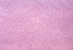 Gram-stained photomicrograph depicting numerous "Pasteurella multocida" bacteria