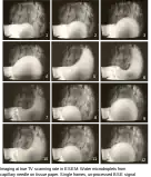 Imaging at true TV scanning rate in ESEM: Water microdroplets from capillary needle on tissue paper. Photos from TV monitor displaying single frames of video recording. Unprocessed BSE signal, field width 380&nbsp;μm.